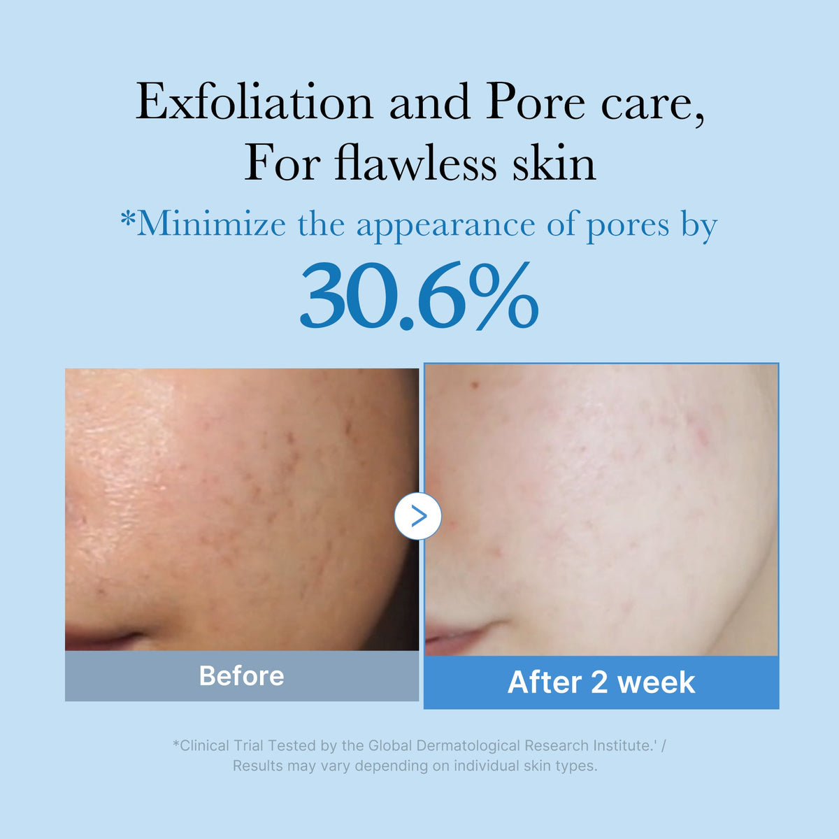 zero-pore-toner-x2 01_d6480b4e-3c08-4954-994a-ed5212c1839c.jpg