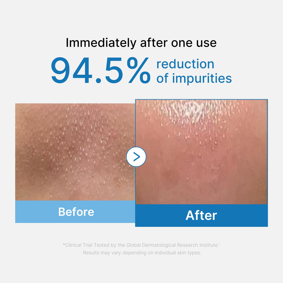 zero-pore-blackhead-deep-cleansing-oil-v5 01_eed557ec-5857-46a2-8b17-dbd67c692dcb.jpg