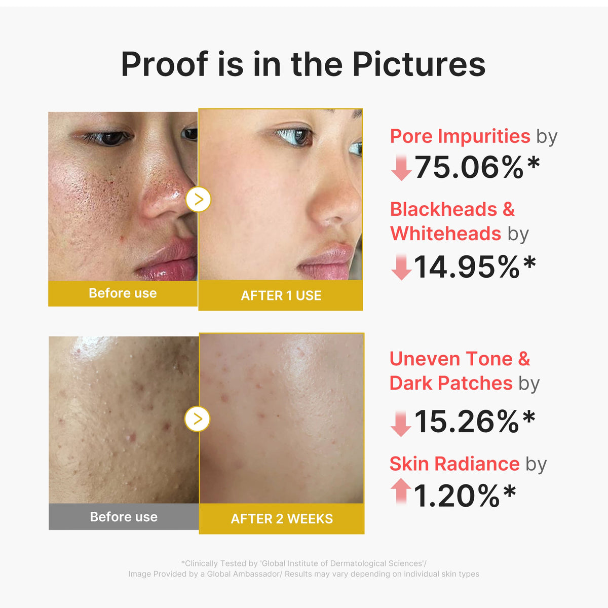 kojic-acid-turmeric-peel-shot-y1 02_45fe66d3-b3f6-4100-aa52-2afd7eded417.jpg