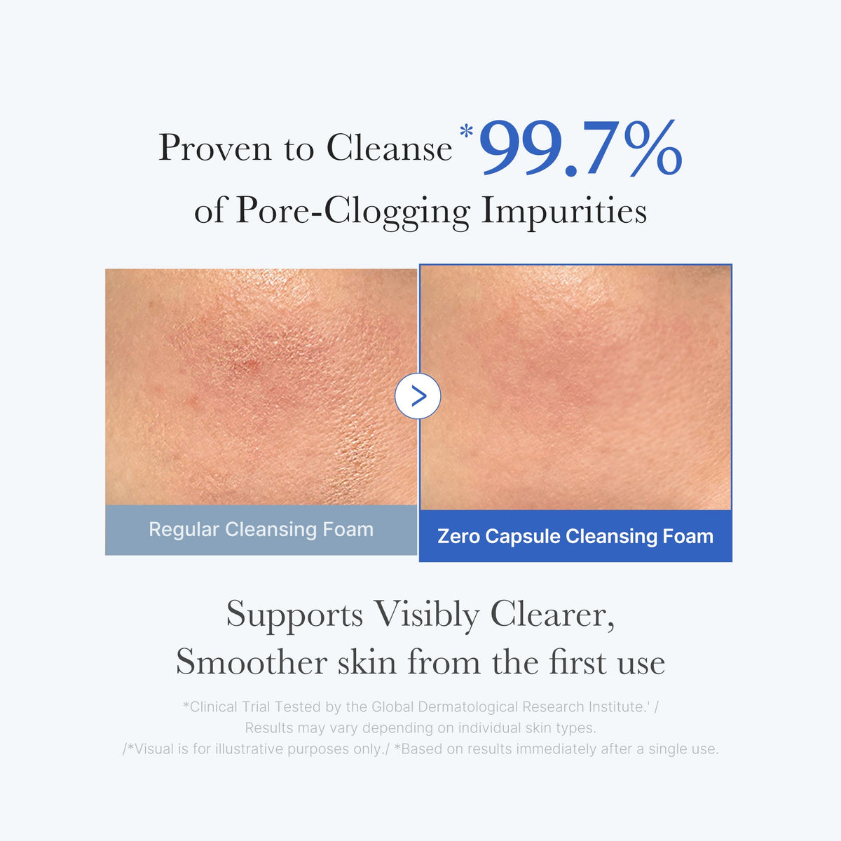 zero-pore-capsule-cleansing-foam-i2 02_c1fb9dfb-86c5-4038-8ff8-490d1006276c.jpg