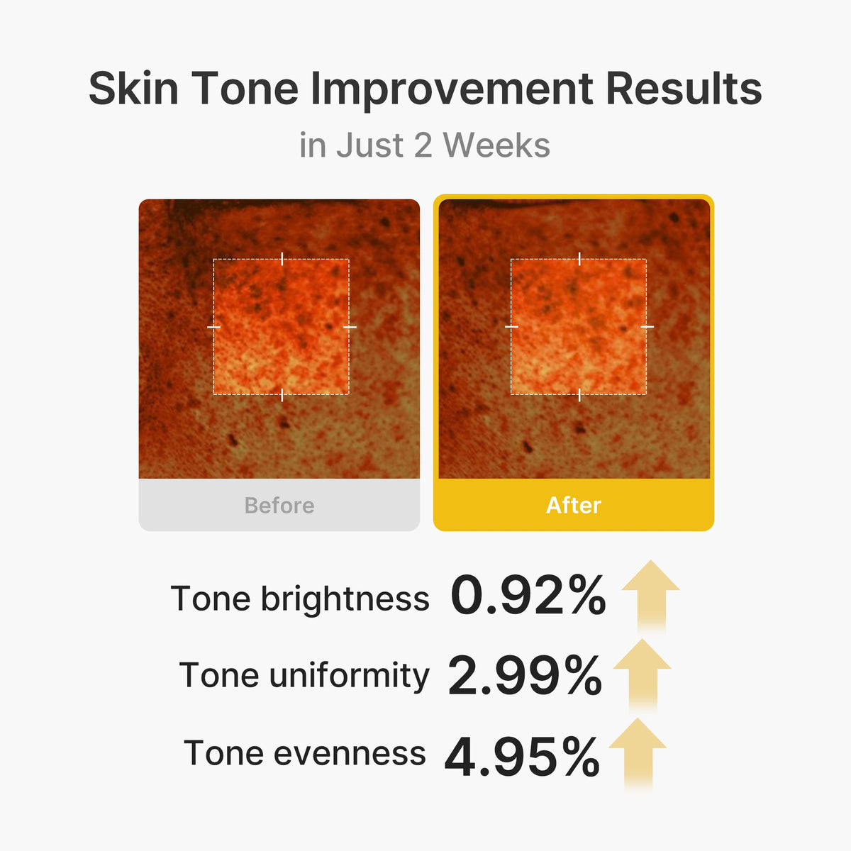 kojic-acid-turmeric-vita-capsule-cream-w0 03_2b626701-fc6c-4702-9e96-a2157a4f7f9d.jpg