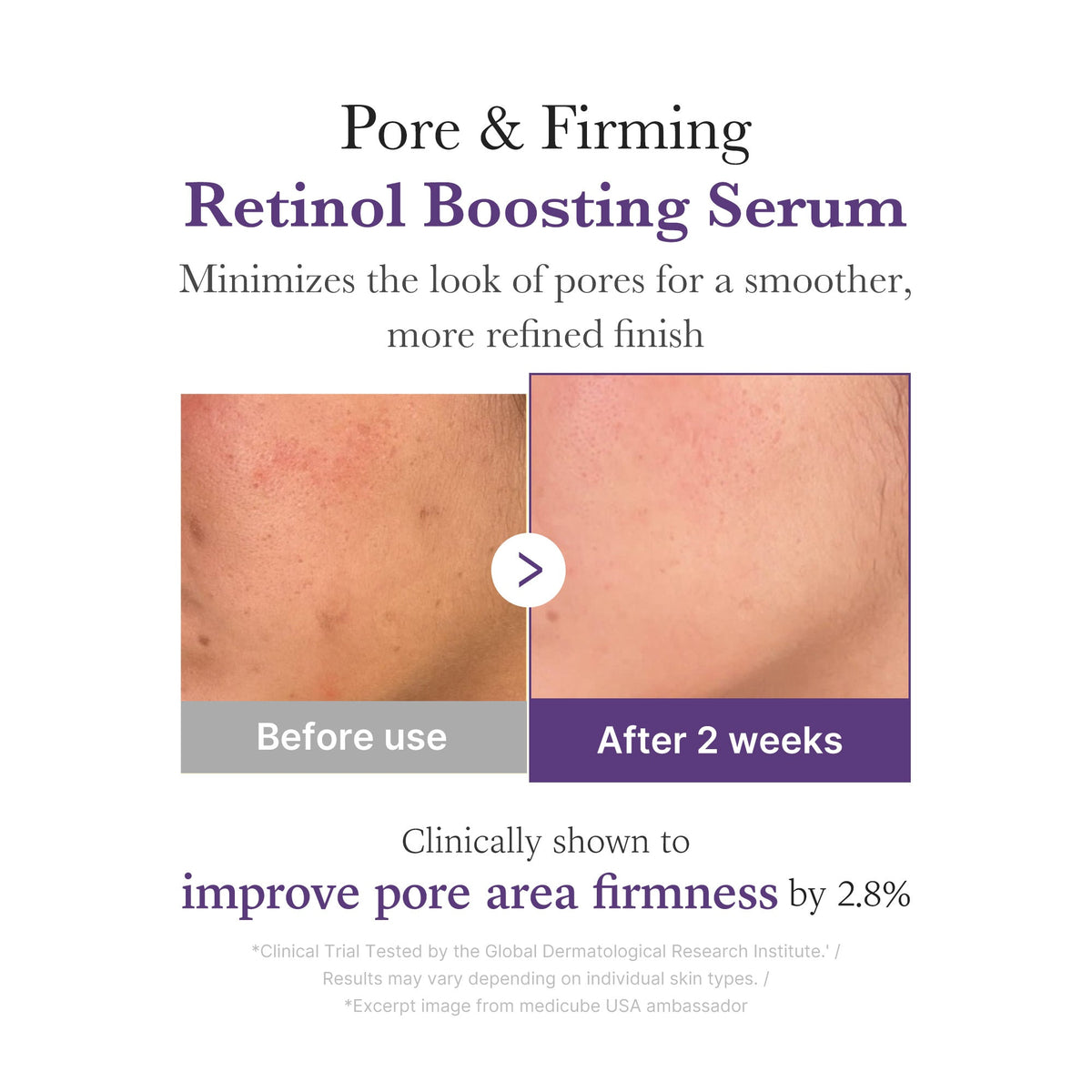 retinol-nmn-boosting-serum-n8 03_3510e7a5-5633-4a18-81ea-1389593bd517.jpg