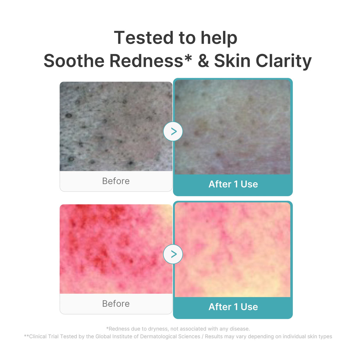 azelaic-acid-capsule-foam-cleanser-t8 03_4aa17579-07e7-4c56-a0cc-f677ec39e4ee.jpg