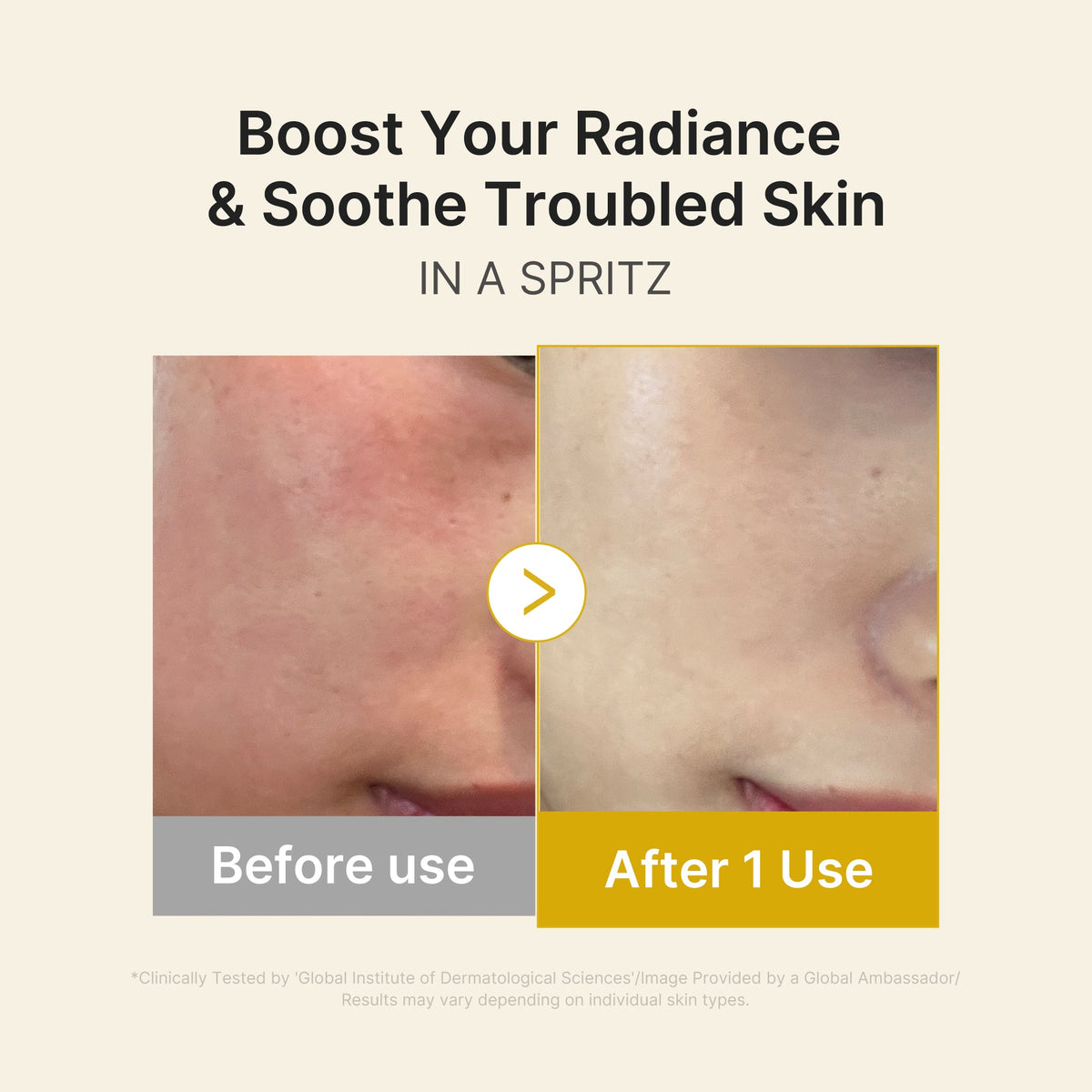 kojic-acid-turmeric-vitamin-gold-jelly-mist-serum-x6 03_dc9cd19e-4e57-49d3-9b66-c7762e8a63f1.jpg
