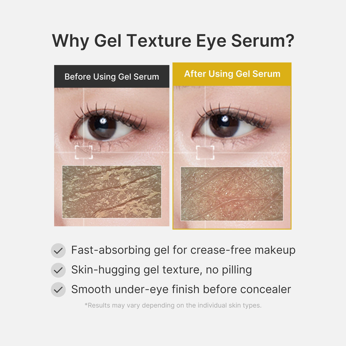 kojic-acid-tumeric-eye-gel-serum-o7 04_0487ef36-49f4-4294-8049-bb55118b05fe.jpg