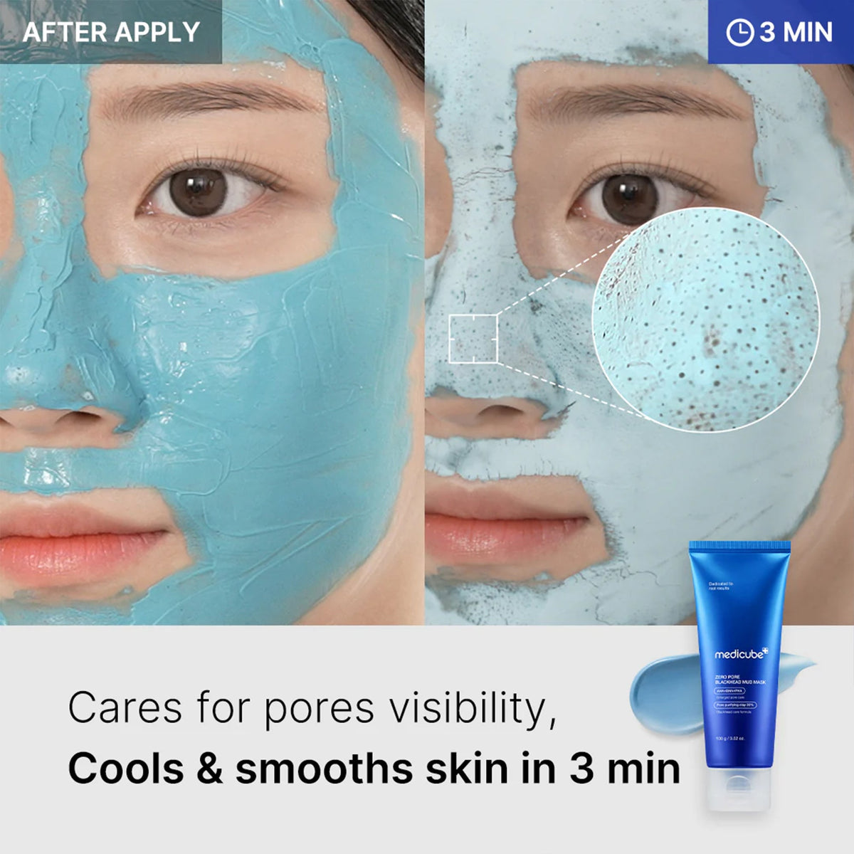 zero-pore-blackhead-mud-mask-a9 04_867c0459-a94e-40d3-bd9a-70400edabe8d.jpg