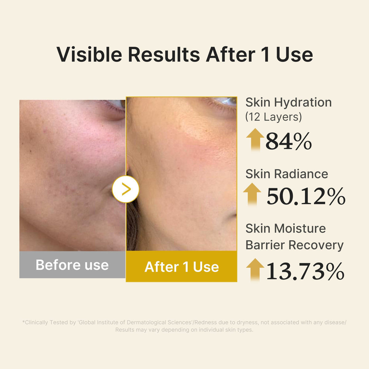 kojic-acid-turmeric-vitamin-gold-jelly-mist-serum-x6 04_d5c55ef1-e03b-494d-bc0d-a1ecc7fc2abf.jpg
