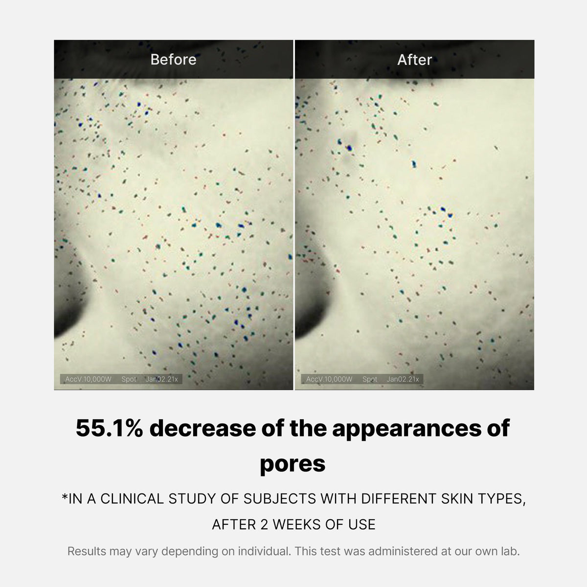 pore-care-duo-f6 05_12ddab8a-64be-4612-8ee1-27e5ec701921.jpg