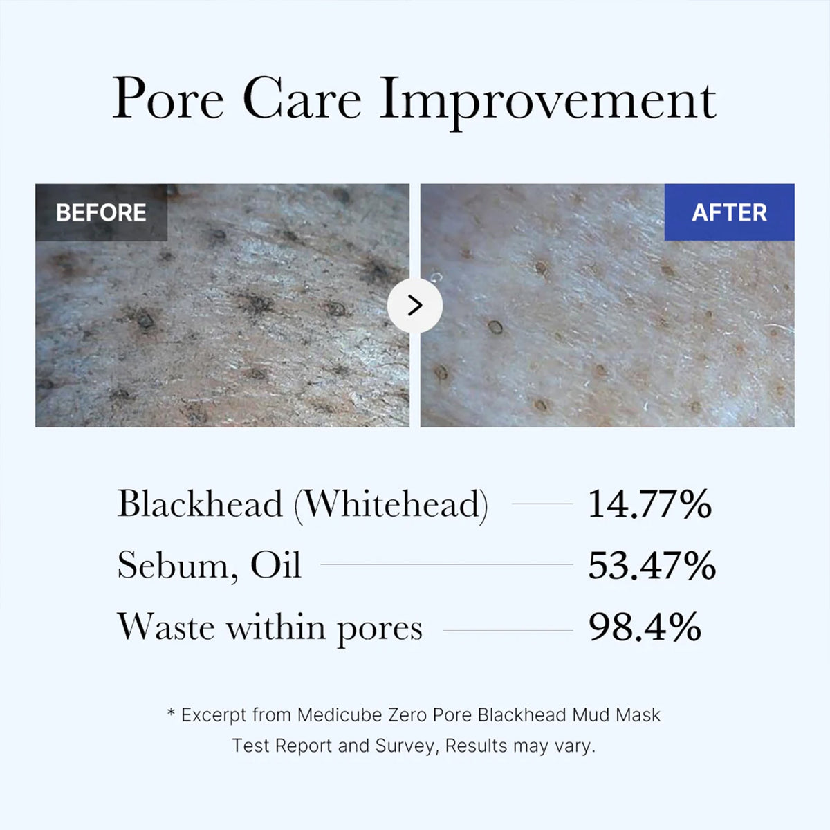 zero-pore-blackhead-mud-mask-a9 05_9362a158-c2b3-4525-acc0-631a2cfdea47.jpg