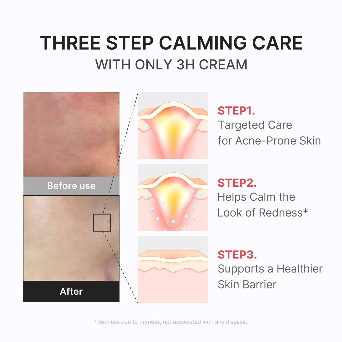 3h-daily-relief-cream-b7 3H_04.jpg