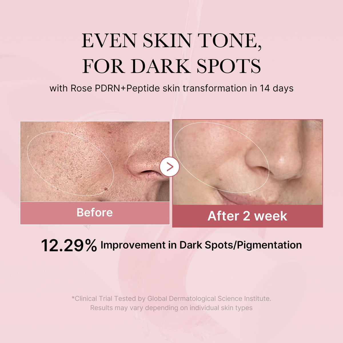 pdrn-pink-peptide-toner-e6 PDRN_01_308c518e-5ac6-4e54-99bd-eabc8796739b.jpg