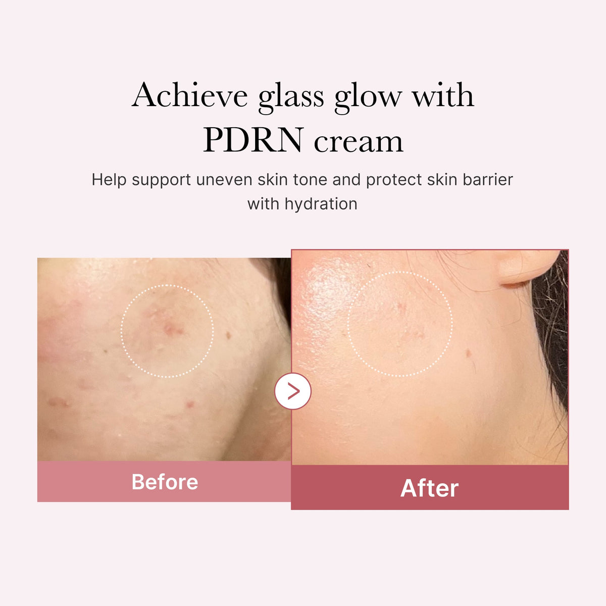 pdrn-pink-peptide-cream-r2 PDRN_02_d7805bfe-cf43-446a-b71b-a276683f136b.jpg
