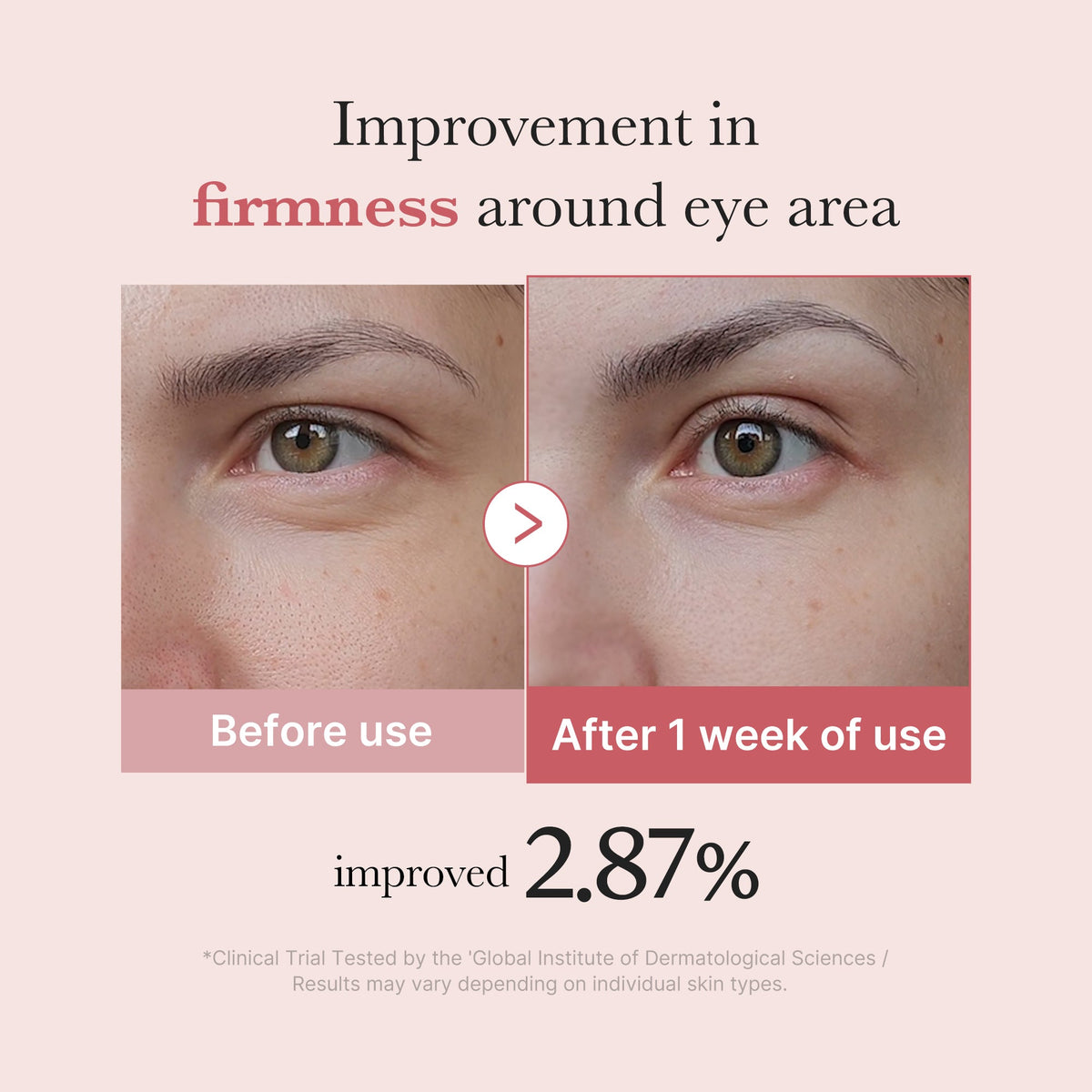 pdrn-pink-peptide-eye-cream-d0 PDRN_03_256dd753-0a2f-41b4-b3cd-bbfd3bc27018.jpg