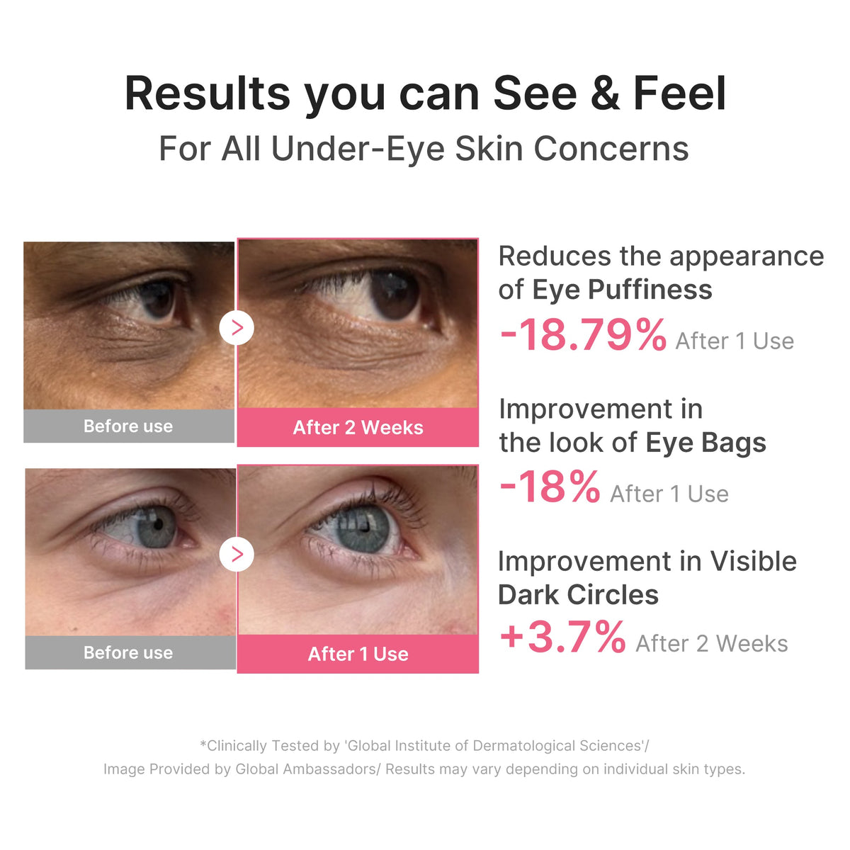 pdrn-caffeine-collagen-eye-patch-n7 PDRN_03_cdce2143-b8d8-43cb-ac69-fcbdf6640249.jpg