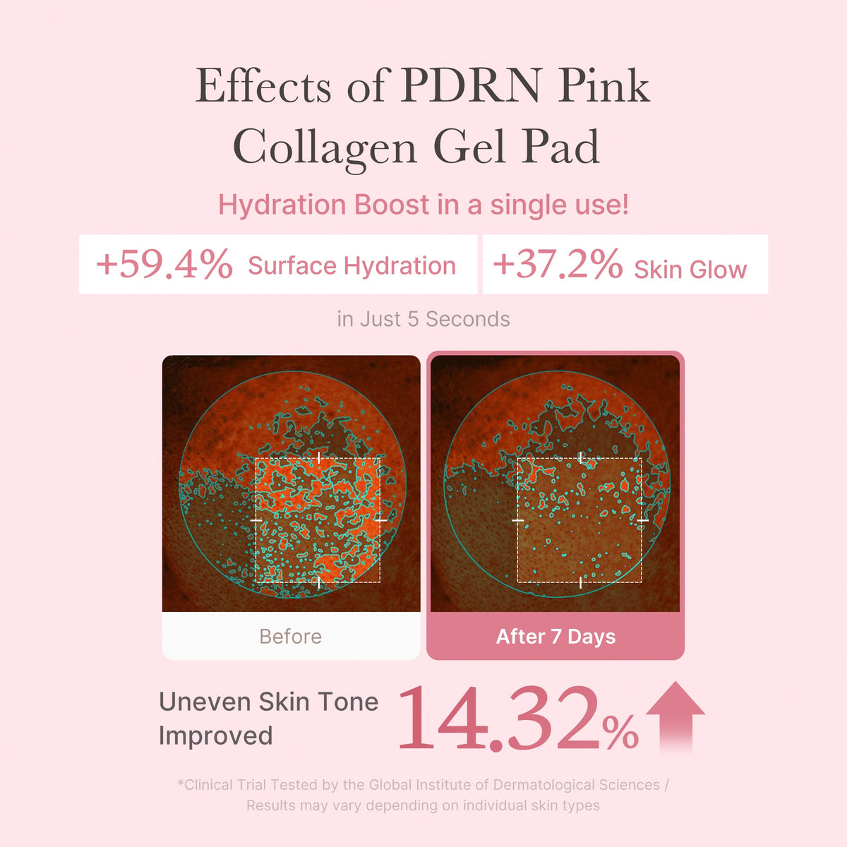 pdrn-pink-collagen-gel-toner-pad-r5 PDRN_04_f9a16a56-8d9e-4c47-a635-ed34ec3ed571.jpg