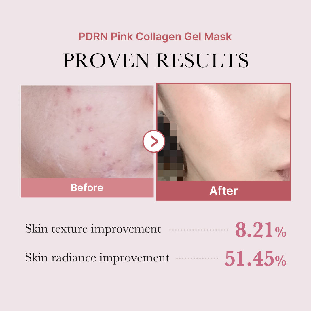 salmon-pdrn-pink-collagen-jelly-gel-mask-n3 PDRN_12.jpg